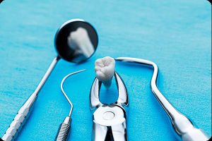 خدمات جراحی دندان